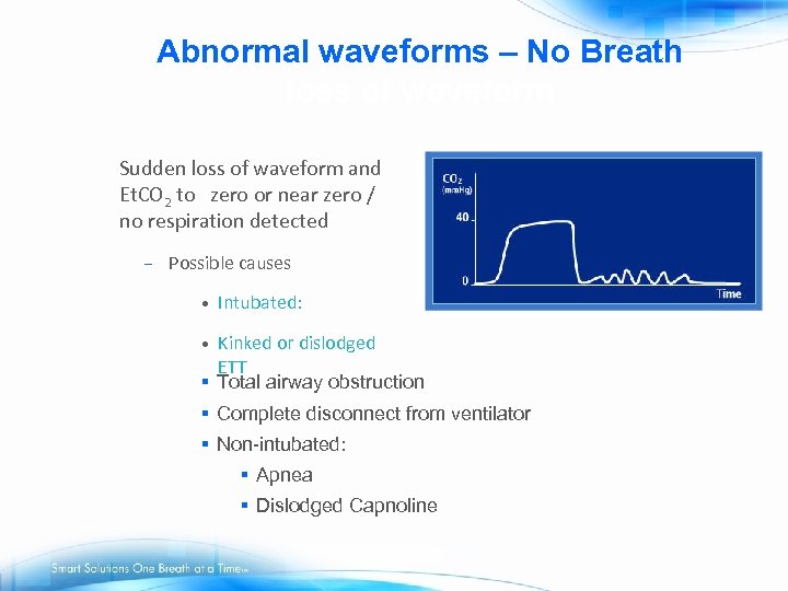 Abnormal waveforms – No Breath loss of waveform Sudden loss of waveform and Et.