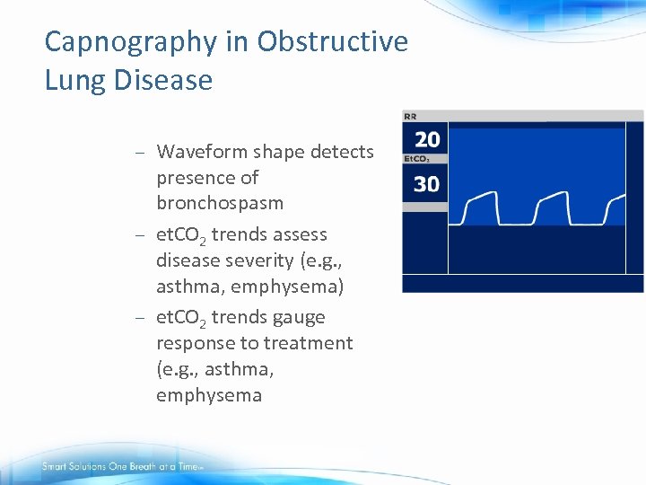 Capnography in Obstructive Lung Disease Waveform shape detects presence of bronchospasm – et. CO