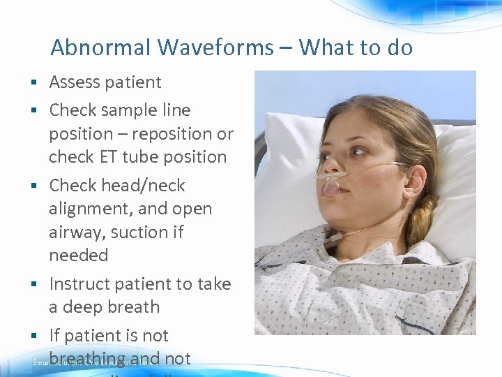 Abnormal Waveforms – What to do § § § Assess patient Check sample line