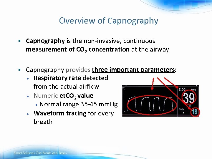 Overview of Capnography § Capnography is the non-invasive, continuous measurement of CO 2 concentration