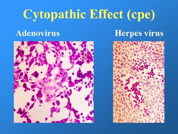 Cytopathic Effect (cpe) Adenovirus Herpes virus 