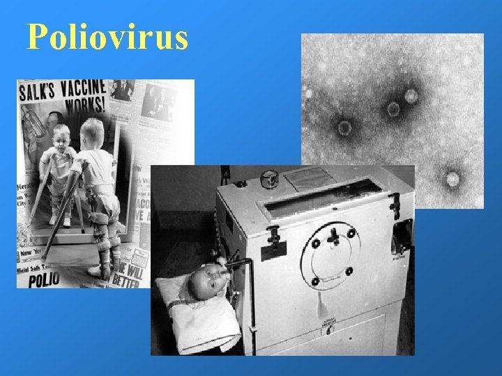 Poliovirus 