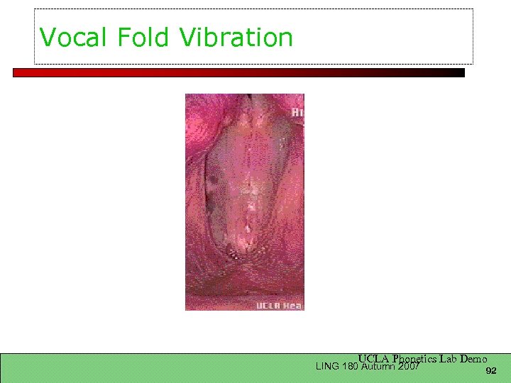 Vocal Fold Vibration UCLA Phonetics Lab Demo LING 180 Autumn 2007 92 