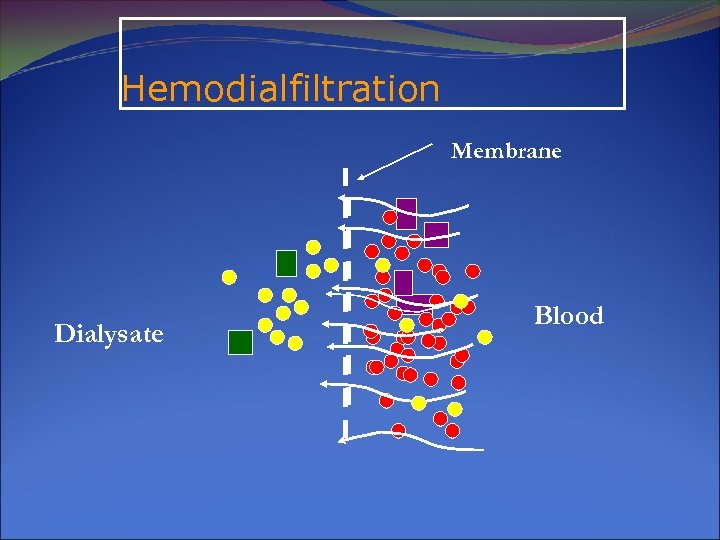 Hemodialfiltration Membrane Dialysate Blood 