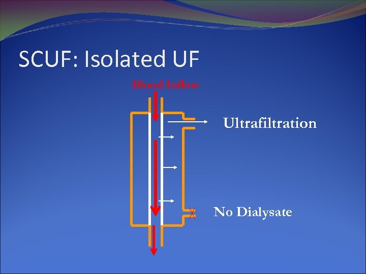 SCUF: Isolated UF Blood Inflow Ultrafiltration No Dialysate 