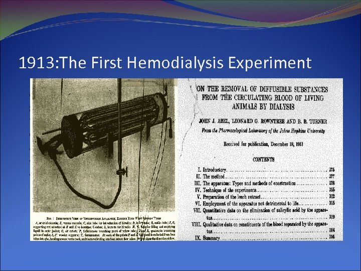 1913: The First Hemodialysis Experiment 