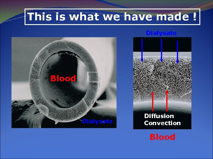 This is what we have made ! Dialysate Blood Dialysate Diffusion Convection Blood 