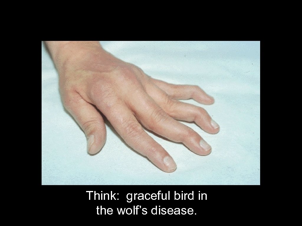 Think: graceful bird in the wolf’s disease. 