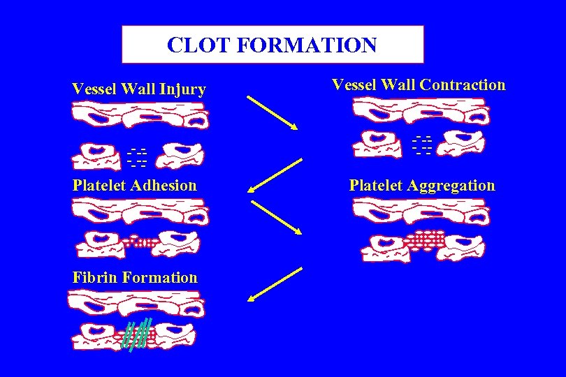 CLOT FORMATION Vessel Wall Injury ------Platelet Adhesion Fibrin Formation Vessel Wall Contraction ------Platelet Aggregation