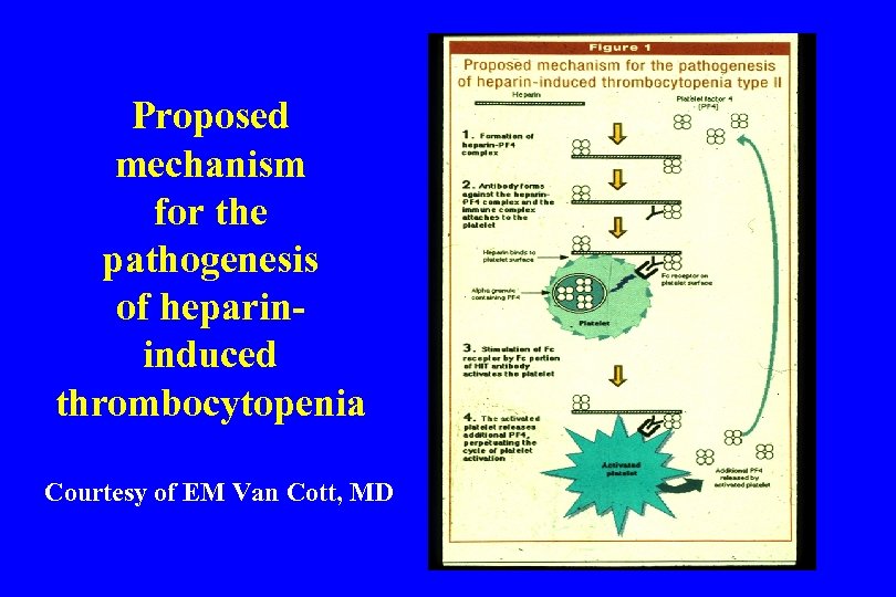 Proposed mechanism for the pathogenesis of heparininduced thrombocytopenia Courtesy of EM Van Cott, MD