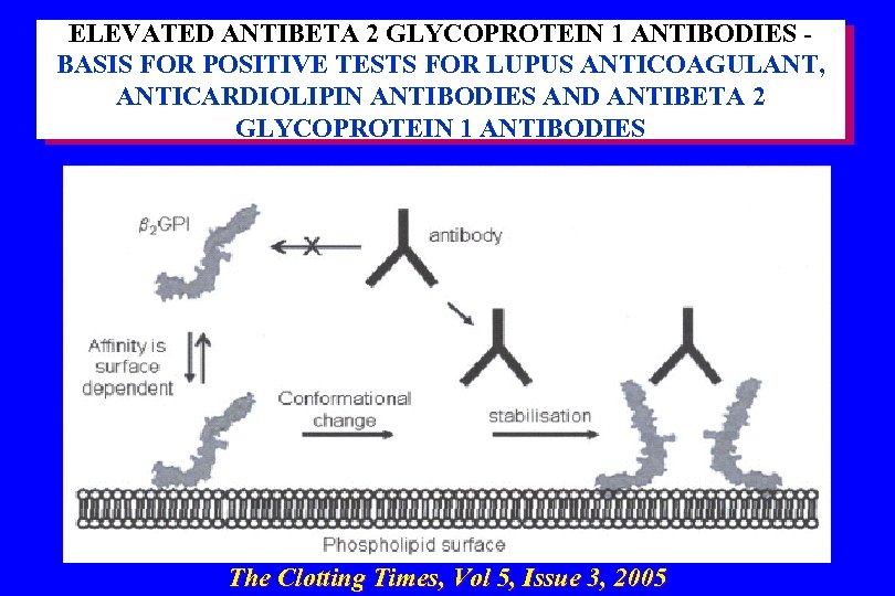 ELEVATED ANTIBETA 2 GLYCOPROTEIN 1 ANTIBODIES BASIS FOR POSITIVE TESTS FOR LUPUS ANTICOAGULANT, ANTICARDIOLIPIN
