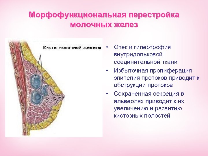 Железистая ткань молочной. Пролиферация эпителия протоков молочной железы. Гландулярная ткань молочной железы. Соединительная ткань молочной железы. Секреция молочной железы.