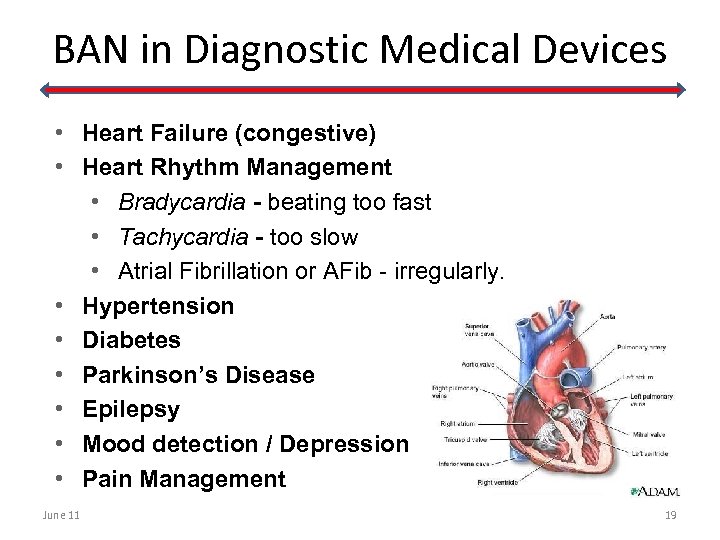 BAN in Diagnostic Medical Devices • Heart Failure (congestive) • Heart Rhythm Management •