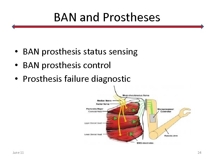 BAN and Prostheses • BAN prosthesis status sensing • BAN prosthesis control • Prosthesis