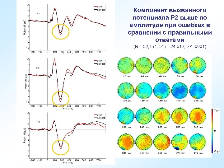 Регистрация слуховых вызванных потенциалов. Метод вызванных потенциалов (ВП). Эндогенные вызванные потенциалы p300. Слуховые вызванные потенциалы. Когнитивные вызванные потенциалы.