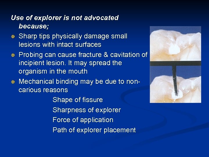 Use of explorer is not advocated because; ] Sharp tips physically damage small lesions