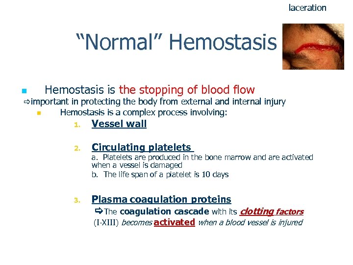 laceration “Normal” Hemostasis n Hemostasis is the stopping of blood flow important in protecting