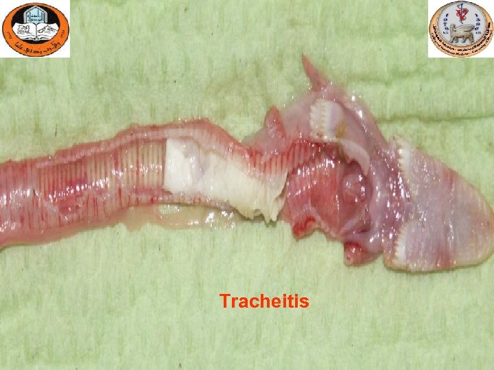 Tracheitis 