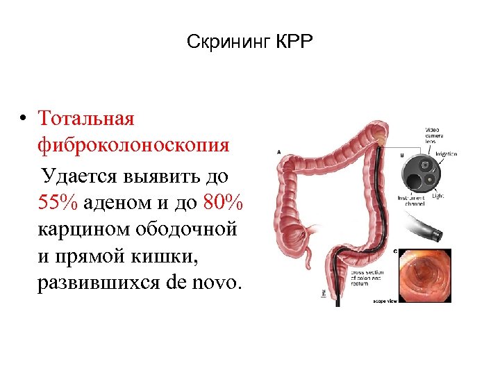 Схема кселокс химиотерапия при раке кишечника