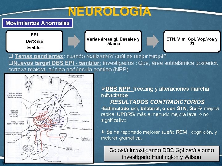 NEUROLOGÍA Movimientos Anormales EPI Distonía temblor Varias áreas gl. Basales y tálamo STN, Vim,