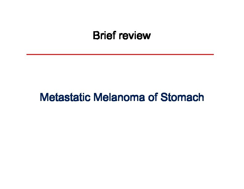 Brief review Metastatic Melanoma of Stomach 