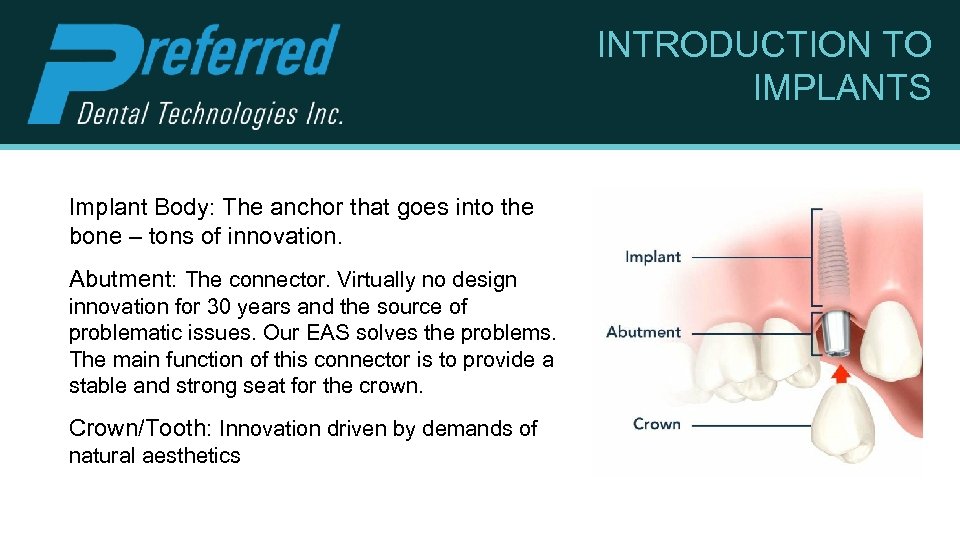 INTRODUCTION TO IMPLANTS Implant Body: The anchor that goes into the bone – tons