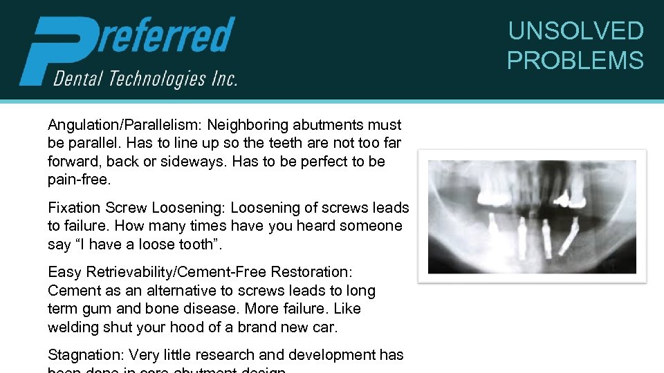 UNSOLVED PROBLEMS Angulation/Parallelism: Neighboring abutments must be parallel. Has to line up so the