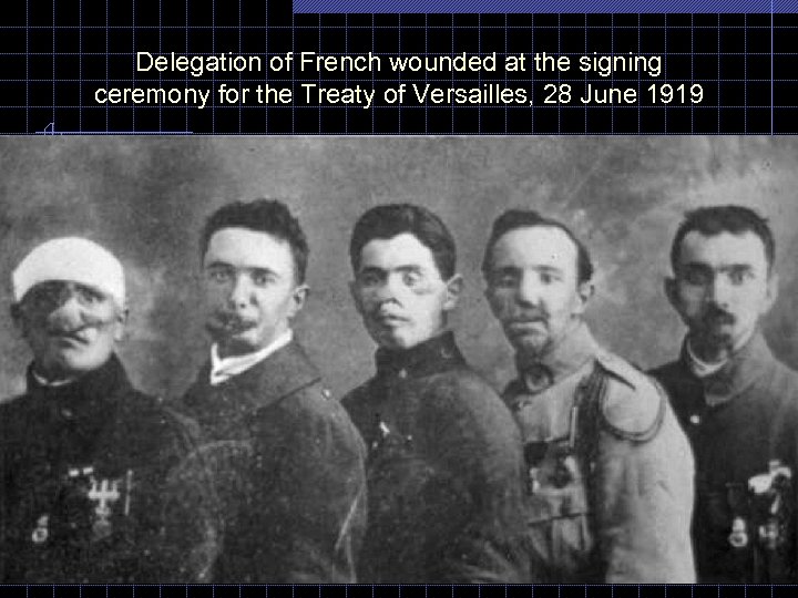 Delegation of French wounded at the signing ceremony for the Treaty of Versailles, 28
