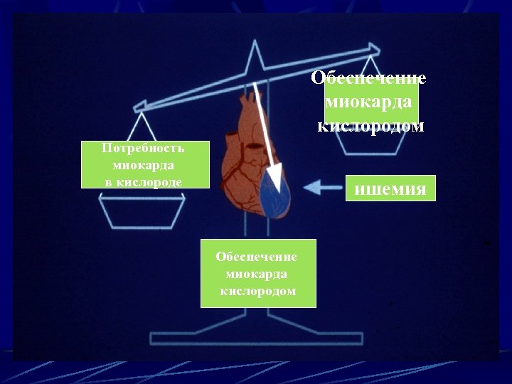 Обеспечение миокарда кислородом Потребность миокарда в кислороде ишемия Обеспечение миокарда кислородом 