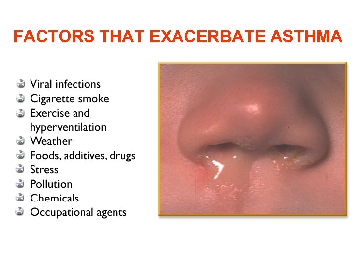 FACTORS THAT EXACERBATE ASTHMA 