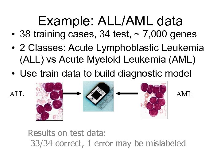 Example: ALL/AML data • 38 training cases, 34 test, ~ 7, 000 genes •