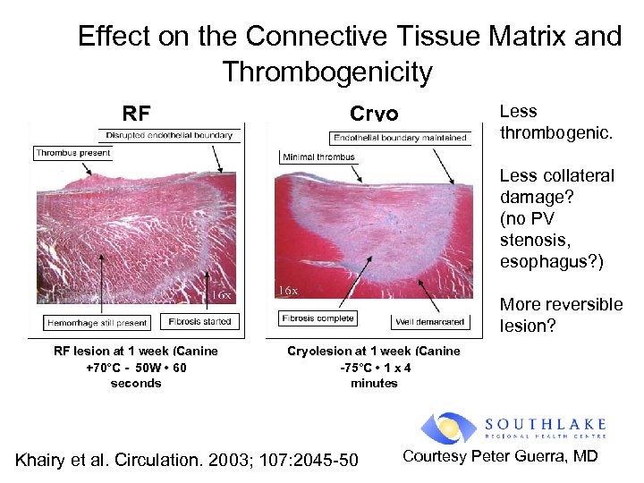 Effect on the Connective Tissue Matrix and Thrombogenicity RF Less thrombogenic. Cryo Less collateral