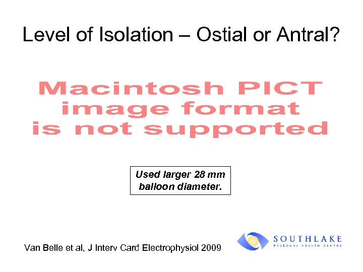 Level of Isolation – Ostial or Antral? Used larger 28 mm balloon diameter. Van