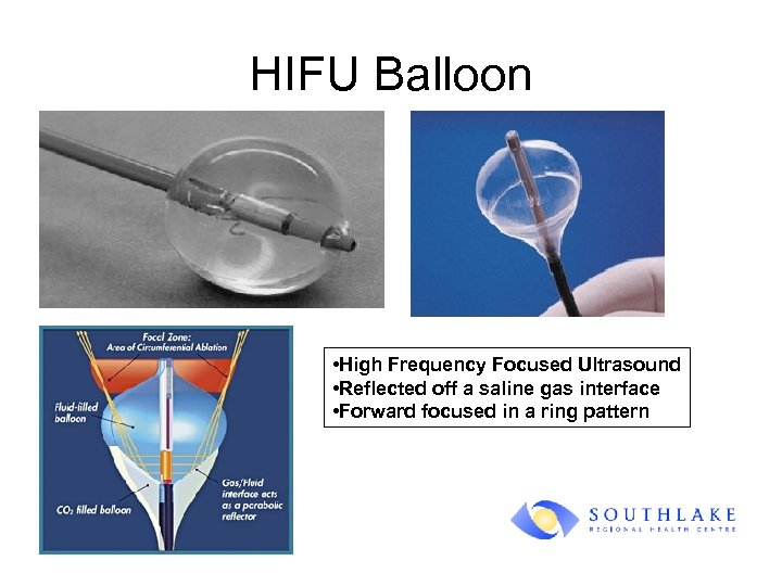 HIFU Balloon • High Frequency Focused Ultrasound • Reflected off a saline gas interface