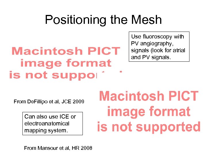 Positioning the Mesh Use fluoroscopy with PV angiography, signals (look for atrial and PV