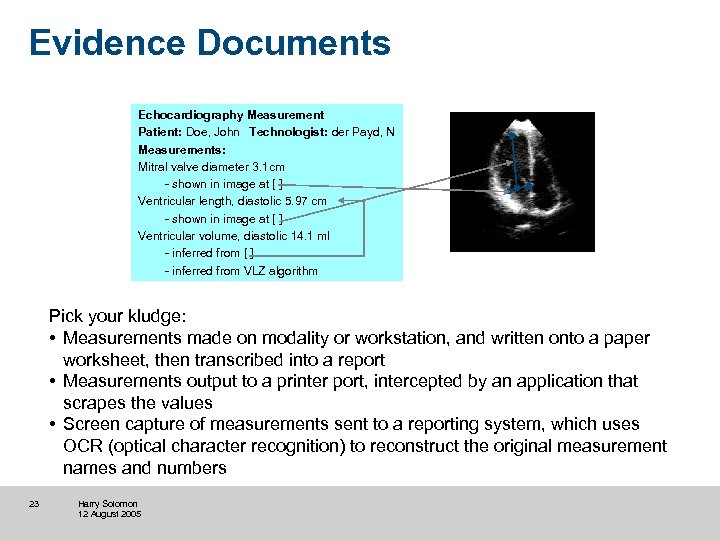 Evidence Documents Echocardiography Measurement Patient: Doe, John Technologist: der Payd, N Measurements: Mitral valve