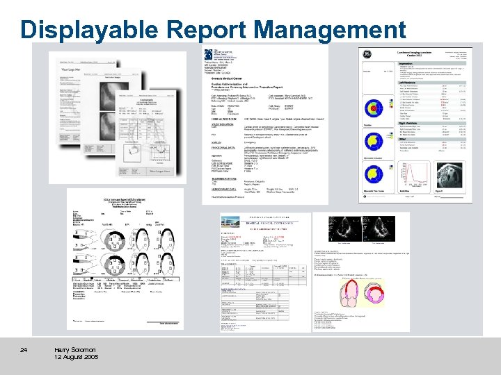 Displayable Report Management 24 Harry Solomon 12 August 2005 