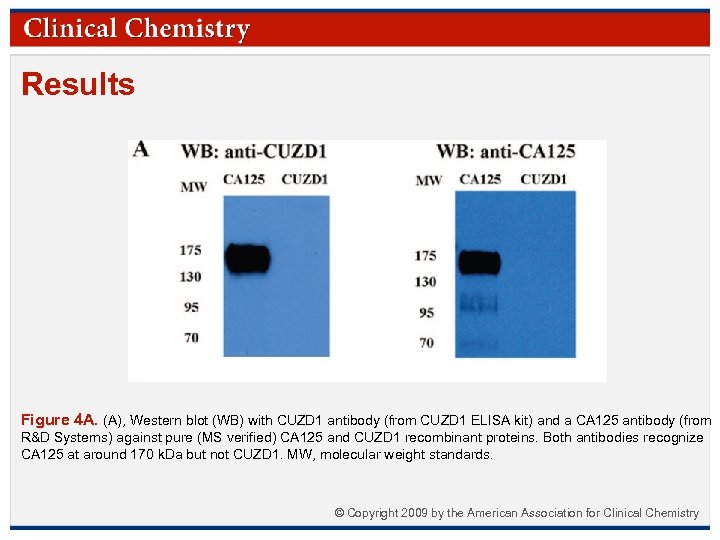 Results Figure 4 A. (A), Western blot (WB) with CUZD 1 antibody (from CUZD