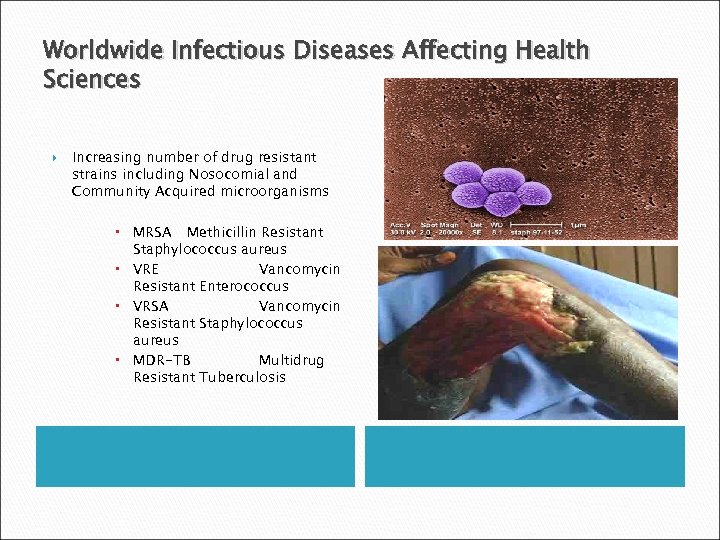 Worldwide Infectious Diseases Affecting Health Sciences Increasing number of drug resistant strains including Nosocomial