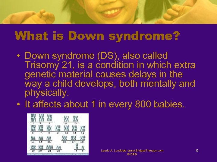 What is Down syndrome? • Down syndrome (DS), also called Trisomy 21, is a