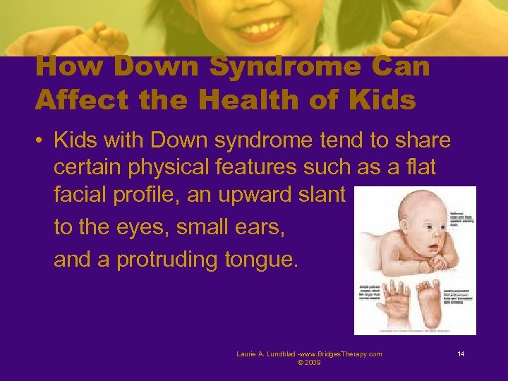 How Down Syndrome Can Affect the Health of Kids • Kids with Down syndrome