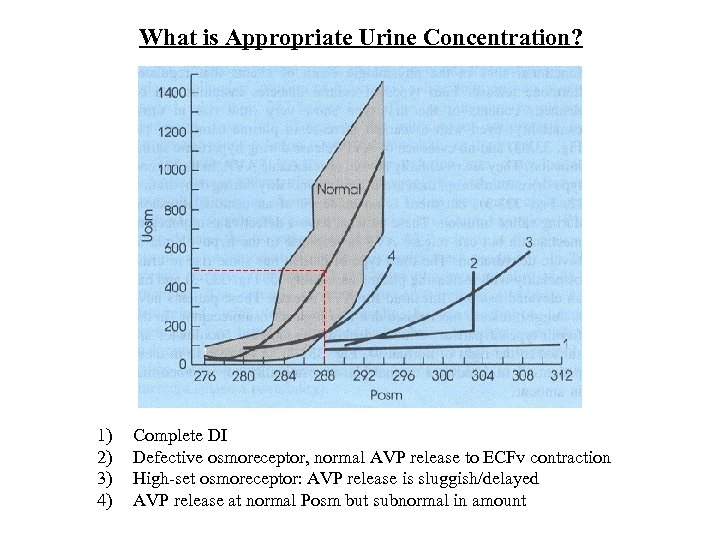 What is Appropriate Urine Concentration? 1) 2) 3) 4) Complete DI Defective osmoreceptor, normal