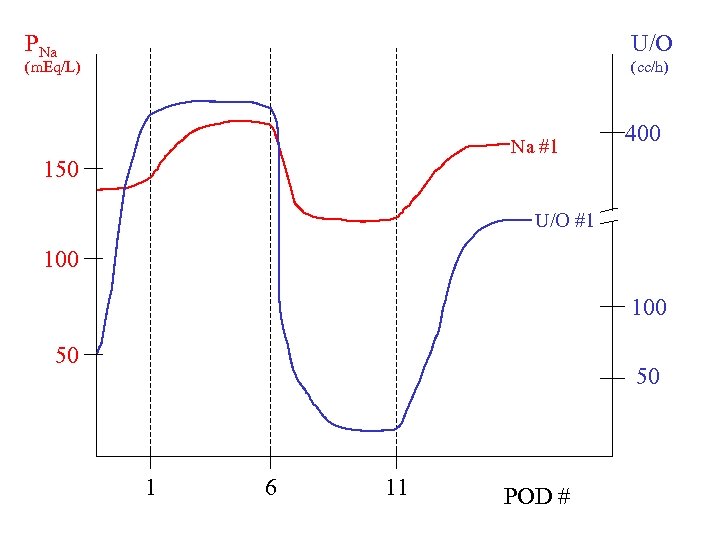 PNa U/O (m. Eq/L) (cc/h) Na #1 150 400 U/O #1 100 50 50