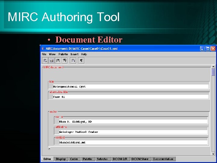 MIRC Authoring Tool • Document Editor 