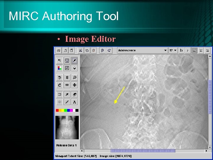 MIRC Authoring Tool • Image Editor 