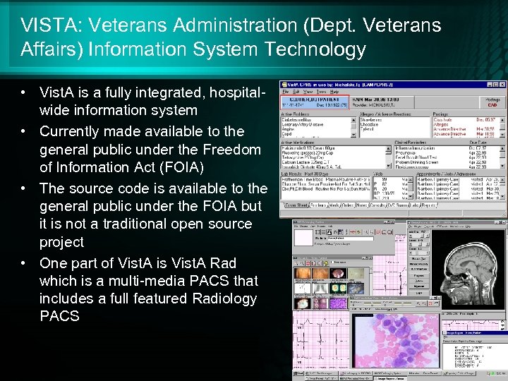 VISTA: Veterans Administration (Dept. Veterans Affairs) Information System Technology • Vist. A is a