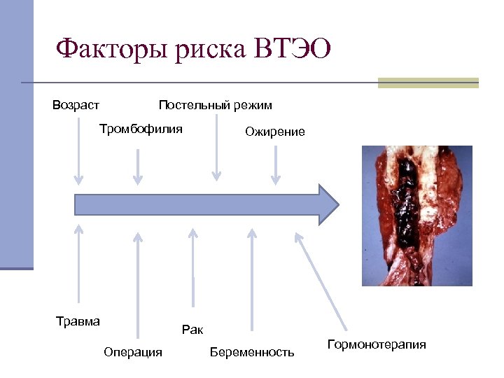 Факторы риска ВТЭО Возраст Постельный режим Тромбофилия Травма Ожирение Рак Операция Беременность Гормонотерапия 