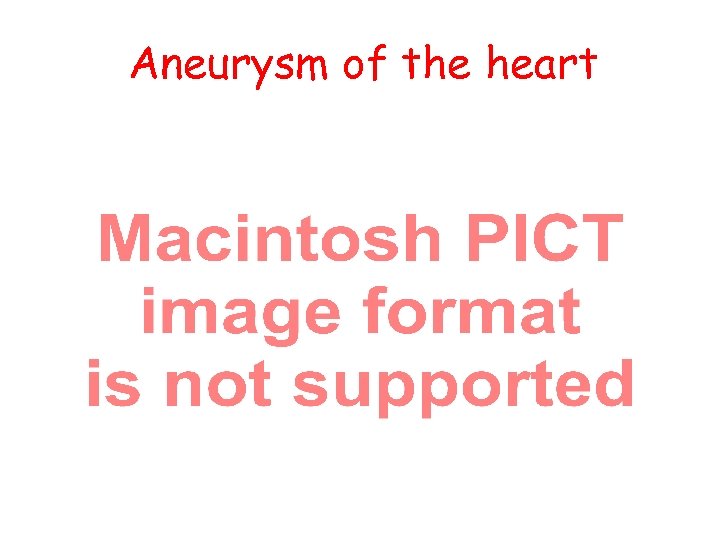 Aneurysm of the heart 