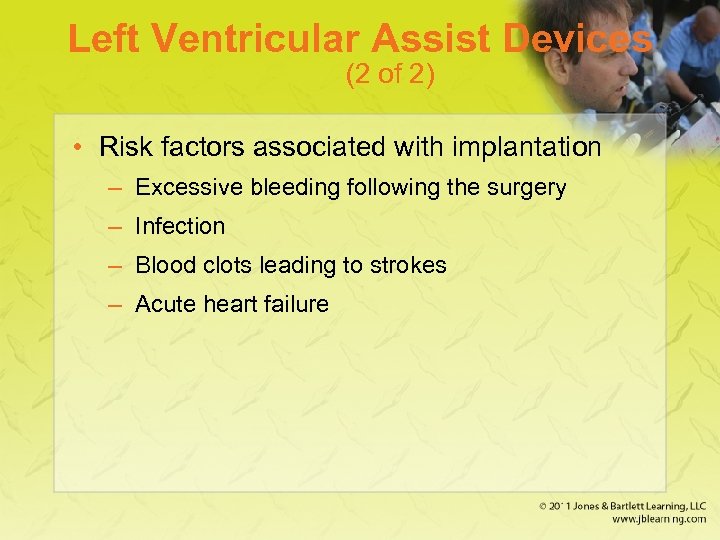 Left Ventricular Assist Devices (2 of 2) • Risk factors associated with implantation –