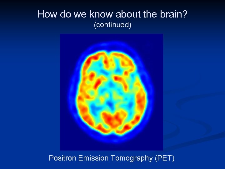 How do we know about the brain? (continued) Public Domain Image: http: //en. wikipedia.
